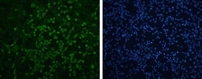 EV71 VP1 antibody detects EV71 VP1 protein by immunofluorescent analysis. Sample: RD cell infected with EV71 were fixed in 4% paraformaldehyde. Green: EV71 VP1 protein stained by EV71 VP1 antibody (NBP3-13087) diluted at 1:100. Blue: DAPI staining. Scale bar = 500 um. 