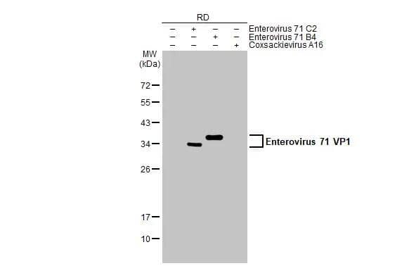 Non-infected (-) and infected (+) RD whole cell extracts (30 ug) were separated by 12% SDS-PAGE, and the membrane was blotted with Enterovirus 71 VP1 antibody (NBP3-13087) diluted at 1:5000. The HRP-conjugated anti-rabbit IgG antibody  was used to detect the primary antibody. 