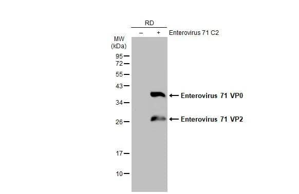 Non-infected (-) and infected (+) RD whole cell extracts (30 ug) were separated by 12% SDS-PAGE, and the membrane was blotted with Enterovirus 71 VP2 antibody (NBP3-13088) diluted at 1:5000. The HRP-conjugated anti-rabbit IgG antibody  was used to detect the primary antibody. 