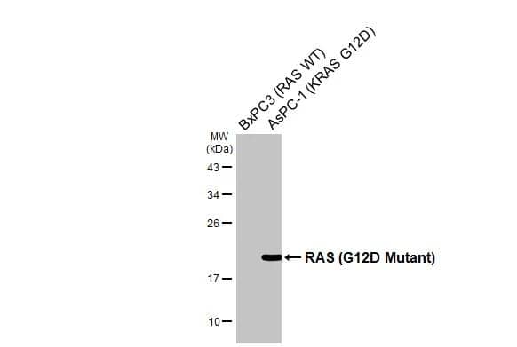 Various whole cell extracts (30 ug) were separated by 12% SDS-PAGE, and the membrane was blotted with RAS (G12D Mutant) antibody (NBP3-13102) diluted at 1:500. The HRP-conjugated anti-rabbit IgG antibody  was used to detect the primary antibody. 