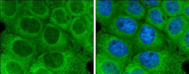 Optineurin antibody detects Optineurin protein at cytoplasm by immunofluorescent analysis.Sample: A431 cells were fixed in 4% paraformaldehyde at RT for 15 min.Green: Optineurin protein stained by Optineurin antibody (NBP3-13114) diluted at 1:500. 