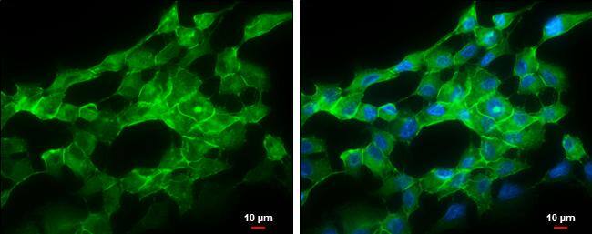 pan Cadherin antibody detects pan Cadherin protein at cell membrane by immunofluorescent analysis.Sample: SK-N-AS cells were fixed in ice-cold MeOH for 5 min.Green: pan Cadherin protein stained by pan Cadherin antibody (NBP3-13122) diluted at 1:500.Blue: Hoechst 33342 staining.Scale bar = 10 um. 