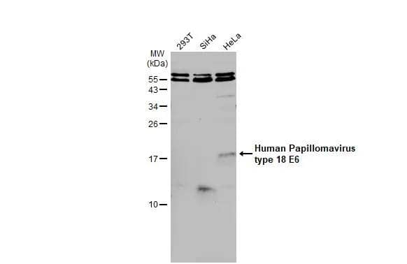 Western Blot HPV18 E6 Antibody - BSA Free
