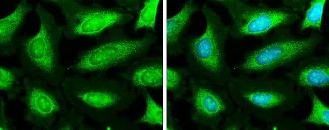 NDUFA9 antibody detects NDUFA9 protein at mitochondria by immunofluorescent analysis.Sample: HeLa cells were fixed in ice-cold MeOH for 5 min.Green: NDUFA9 stained by NDUFA9 antibody (NBP3-13135) diluted at 1:500.Blue: Hoechst 33342 staining. 