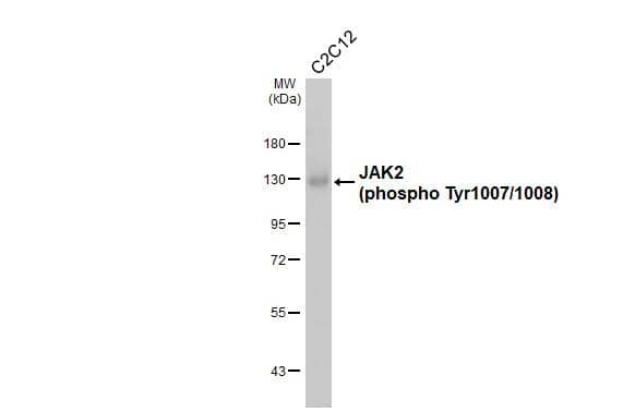 Whole cell extract (30 ug) was separated by 7.5% SDS-PAGE, and the membrane was blotted with JAK2 (phospho Tyr1007/1008) antibody (NBP3-13138) diluted at 1:1000. The HRP-conjugated anti-rabbit IgG antibody  was used to detect the primary antibody. 