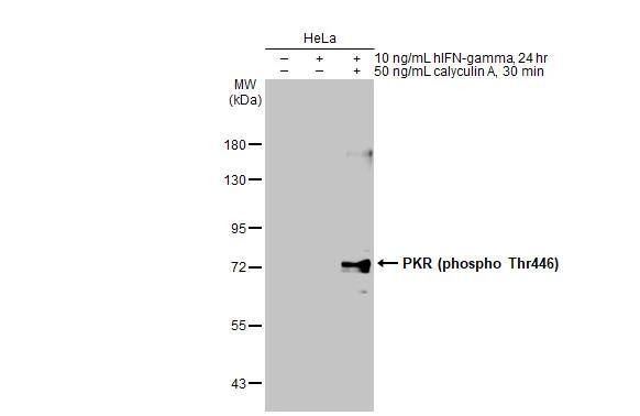 Untreated (-) and treated (+) HeLa whole cell extracts (30 ug) were separated by 7.5% SDS-PAGE, and the membrane was blotted with PKR (phospho Thr446) antibody (NBP3-13141) diluted at 1:500. The HRP-conjugated anti-rabbit IgG antibody  was used to detect the primary antibody, and the signal was developed with Trident ECL plus-Enhanced. 