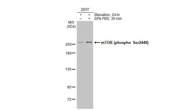 Untreated (-) and treated (+) 293T whole cell extracts (30 ug) were separated by 5% SDS-PAGE, and the membrane was blotted with mTOR (phospho Ser2448) antibody (NBP3-13144) diluted at 1:1000. The HRP-conjugated anti-rabbit IgG antibody  was used to detect the primary antibody. 