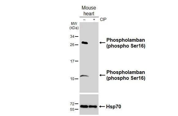 Untreated (-) and treated (+) mouse tissue extracts (50 ug) were separated by 15% SDS-PAGE, and the membrane was blotted with Phospholamban (phospho Ser16) antibody (NBP3-13146) diluted at 1:1000. The HRP-conjugated anti-rabbit IgG antibody  was used to detect the primary antibody. 