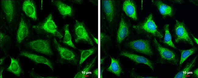COX4I2 antibody detects COX4I2 protein at mitochondria by immunofluorescent analysis.Sample: HeLa cells were fixed in 4% paraformaldehyde at RT for 15 min.Green: COX4I2 stained by COX4I2 antibody (NBP3-13152) diluted at 1:1000.Blue: Hoechst 33342 staining.Scale bar= 10um. 