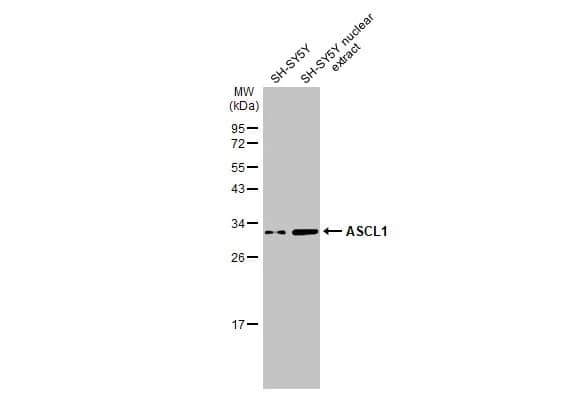 Western Blot: ASCL1/Mash1 Antibody [NBP3-13159] - SH-SY5Y whole cell and nuclear extracts (30 ug) were separated by 12% SDS-PAGE, and the membrane was blotted with ASCL1/Mash1 antibody (NBP3-13159) diluted at 1:1000. The HRP-conjugated anti-rabbit IgG antibody  was used to detect the primary antibody.