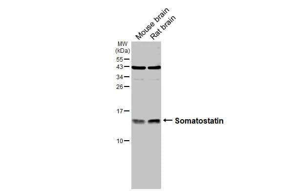 Various tissue extracts (50 ug) were separated by 15% SDS-PAGE, and the membrane was blotted with Somatostatin antibody (NBP3-13160) diluted at 1:500. The HRP-conjugated anti-rabbit IgG antibody  was used to detect the primary antibody, and the signal was developed with Trident ECL plus-Enhanced. 
