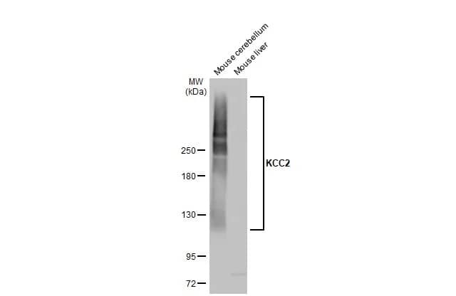 Western Blot: KCC2/SLC12A5 Antibody [NBP3-13161] - Various tissue extracts (50 ug) were separated by 5% SDS-PAGE, and the membrane was blotted with KCC2/SLC12A5 antibody (NBP3-13161) diluted at 1:5000. The HRP-conjugated anti-rabbit IgG antibody  was used to detect the primary antibody.