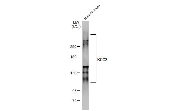 Western Blot: KCC2/SLC12A5 Antibody [NBP3-13161] - Human brain (5 ug) was separated by 5% SDS-PAGE, and the membrane was blotted with KCC2/SLC12A5 antibody (NBP3-13161) diluted at 1:500. The HRP-conjugated anti-rabbit IgG antibody  was used to detect the primary antibody.