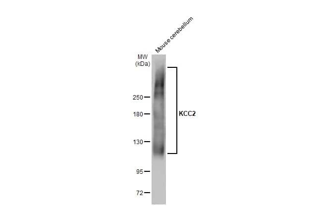 Western Blot: KCC2/SLC12A5 Antibody [NBP3-13161] - Mouse tissue extract (50 ug) was separated by 5% SDS-PAGE, and the membrane was blotted with KCC2/SLC12A5 antibody (NBP3-13161) diluted at 1:5000. The HRP-conjugated anti-rabbit IgG antibody  was used to detect the primary antibody.