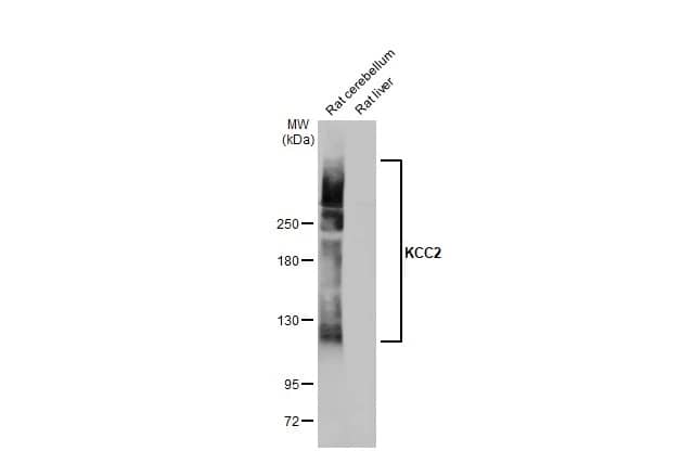 Western Blot: KCC2/SLC12A5 Antibody [NBP3-13161] - Various tissue extracts (50 ug) were separated by 5% SDS-PAGE, and the membrane was blotted with KCC2/SLC12A5 antibody (NBP3-13161) diluted at 1:500. The HRP-conjugated anti-rabbit IgG antibody  was used to detect the primary antibody.