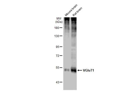 Western Blot: VGLUT1 Antibody [NBP3-13165] - Various tissue extracts (50 ug) were separated by 7.5% SDS-PAGE, and the membrane was blotted with VGLUT1 antibody (NBP3-13165) diluted at 1:5000. The HRP-conjugated anti-rabbit IgG antibody  was used to detect the primary antibody.