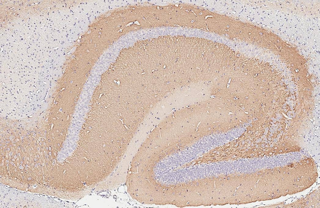 Immunohistochemistry-Paraffin VGLUT1 Antibody - BSA Free