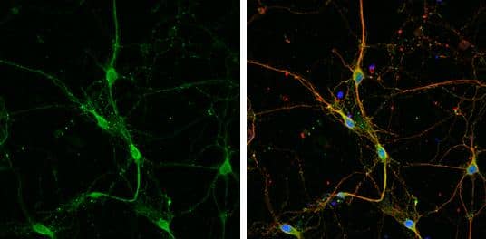 GABA Transporter 1 / GAT1 antibody detects GABA Transporter 1 / GAT1 protein by immunofluorescent analysis.Sample: DIV9 rat E18 primary cortical neuron cells were fixed in 4% paraformaldehyde at RT for 15 min.Green: GABA Transporter 1 / GAT1 stained by GABA Transporter 1 / GAT1 antibody (NBP3-13166) diluted at 1:500.Red: beta Tubulin 3/ Tuj1, stained by beta Tubulin 3/ Tuj1 antibody [GT1338]  diluted at 1:500.Blue: Fluoroshield with DAPI . 