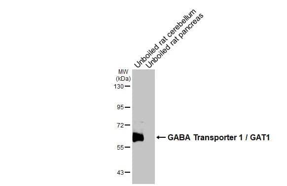 Unboiled various tissue extracts (50 ug) were separated by 7.5% SDS-PAGE, and the membrane was blotted with GABA Transporter 1 / GAT1 antibody (NBP3-13166) diluted at 1:500. The HRP-conjugated anti-rabbit IgG antibody  was used to detect the primary antibody. 