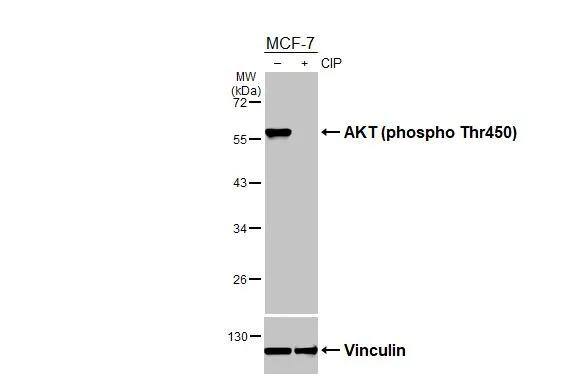 Untreated (-) and treated (+) MCF-7 whole cell extracts (30 ug) were separated by 10% SDS-PAGE, and the membrane was blotted with AKT (phospho Thr450) antibody (NBP3-13168) diluted at 1:1000. The HRP-conjugated anti-rabbit IgG antibody  was used to detect the primary antibody. 
