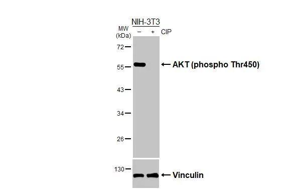 Untreated (-) and treated (+) NIH-3T3 whole cell extracts (30 ug) were separated by 10% SDS-PAGE, and the membrane was blotted with AKT (phospho Thr450) antibody (NBP3-13168) diluted at 1:500. The HRP-conjugated anti-rabbit IgG antibody  was used to detect the primary antibody. 