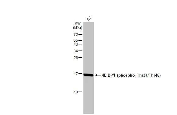 Whole cell extract (30 ug) was separated by 15% SDS-PAGE, and the membrane was blotted with 4E-BP1 (phospho Thr37/Thr46) antibody (NBP3-13169) diluted at 1:1000. The HRP-conjugated anti-rabbit IgG antibody  was used to detect the primary antibody, and the signal was developed with Trident ECL plus-Enhanced. 