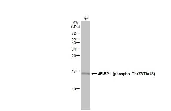 Western Blot: 4EBP1 [p Thr46, p Thr37] Antibody [NBP3-13170] - Whole cell extract (30 ug) was separated by 15% SDS-PAGE, and the membrane was blotted with 4EBP1 antibody (NBP3-13170) diluted at 1:1000. The HRP-conjugated anti-rabbit IgG antibody  was used to detect the primary antibody.