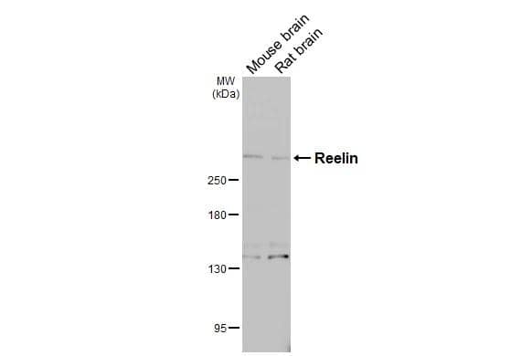 Various tissue extracts (50 ug) were separated by 5% SDS-PAGE, and the membrane was blotted with Reelin antibody (NBP3-13177) diluted at 1:1000. The HRP-conjugated anti-rabbit IgG antibody  was used to detect the primary antibody. 