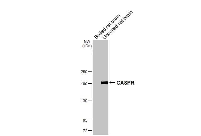 Boiled and unboiled rat tissue extracts (50 ug) were separated by 5% SDS-PAGE, and the membrane was blotted with CASPR antibody (NBP3-13184) diluted at 1:1000. The HRP-conjugated anti-rabbit IgG antibody  was used to detect the primary antibody. 