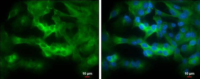 Immunocytochemistry/ Immunofluorescence STRN4 Antibody