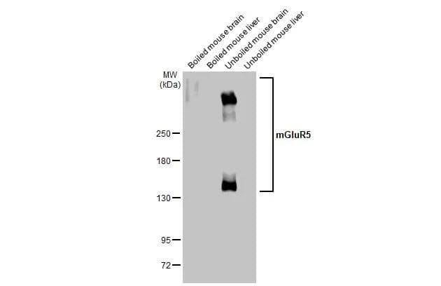 Boiled and unboiled various tissue extracts (50 ug) were separated by 5% SDS-PAGE, and the membrane was blotted with mGluR5 antibody (NBP3-13190) diluted at 1:500. The HRP-conjugated anti-rabbit IgG antibody  was used to detect the primary antibody. 