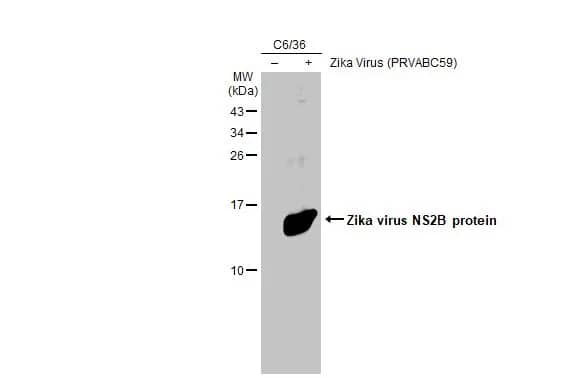 Western Blot: Zika virus NS2B Antibody [NBP3-13195] - Non-infected (-) and infected (+) C6/36 whole cell extracts (30 ug) were separated by 15% SDS-PAGE, and the membrane was blotted with Zika virus NS2B antibody (NBP3-13195) diluted at 1:5000. The HRP-conjugated anti-rabbit IgG antibody  was used to detect the primary antibody.