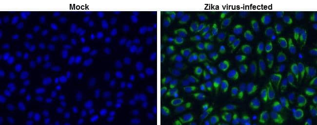 Zika virus NS2B protein antibody detects Zika virus NS2B protein at cytoplasm by immunofluorescent analysis.Sample: Vero cells were fixed in 4% paraformaldehyde at RT for 30 min.Green: Zika virus NS2B stained by Zika virus NS2B protein antibody (NBP3-13201) diluted at 1:1000.Blue: nuclear staining. 