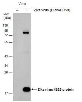 Non-infected (-) and infected (+) Vero whole cell extracts (30 ug) were separated by 12% SDS-PAGE, and the membrane was blotted with Zika virus NS2B protein antibody (NBP3-13201) diluted at 1:15000. 