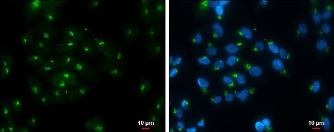 Rap1GAP antibody detects Rap1GAP protein at Golgi apparatus by immunofluorescent analysis.Sample: SK-N-AS cells were fixed in ice-cold MeOH for 5 min.Green: Rap1GAP protein stained by Rap1GAP antibody (NBP3-13211) diluted at 1:500.Blue: Hoechst 33342 staining.Scale bar = 10 um. 