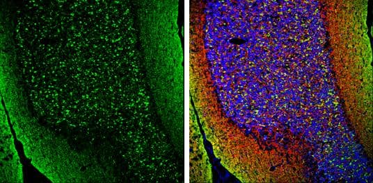 alpha Synuclein antibody detects alpha Synuclein protein expression by immunohistochemical analysis.Sample: Frozen-sectioned adult mouse cerebellum. Green: alpha Synuclein protein stained by alpha Synuclein antibody (NBP3-13218) diluted at 1:250.Red: beta Tubulin 3/ TUJ1, stained by beta Tubulin 3/ TUJ1 antibody [GT11710]  diluted at 1:500.Blue: Fluoroshield with DAPI . 