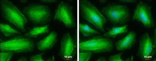 MYH10 antibody detects MYH10 protein at cytoskeleton by immunofluorescent analysis.Sample: HeLa cells were fixed in ice-cold MeOH for 5 min.Green: MYH10 protein stained by MYH10 antibody (NBP3-13221) diluted at 1:500.Blue: Hoechst 33342 staining.Scale bar = 10 um. 