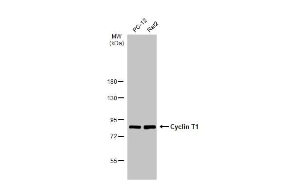 Western Blot: Cyclin T1 Antibody [NBP3-13224] - Various whole cell extracts (30 ug) were separated by 7.5% SDS-PAGE, and the membrane was blotted with Cyclin T1 antibody (NBP3-13224) diluted at 1:1000. The HRP-conjugated anti-rabbit IgG antibody  was used to detect the primary antibody.