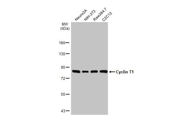 Western Blot: Cyclin T1 Antibody [NBP3-13224] - Various whole cell extracts (30 ug) were separated by 7.5% SDS-PAGE, and the membrane was blotted with Cyclin T1 antibody (NBP3-13224) diluted at 1:1000. The HRP-conjugated anti-rabbit IgG antibody  was used to detect the primary antibody.