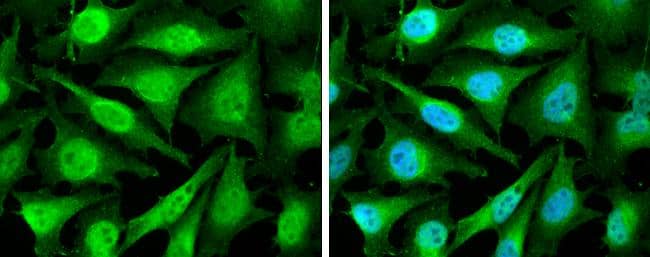 Immunocytochemistry/ Immunofluorescence Cyclin D2 Antibody - BSA Free