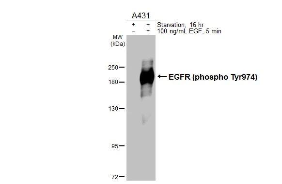 <b>Biological Strategies Validation. </b>Untreated (-) and treated (+) A431 whole cell extracts (30 ug) were separated by 7.5% SDS-PAGE, and the membrane was blotted with EGFR (phospho Tyr974) antibody (NBP3-13227) diluted at 1:2000. The HRP-conjugated anti-rabbit IgG antibody  was used to detect the primary antibody. 