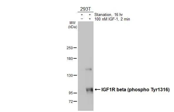 <b>Biological Strategies Validation. </b>Untreated (-) and treated (+) 293T whole cell extracts (30 ug) were separated by 5% SDS-PAGE, and the membrane was blotted with IGF1R beta (phospho Tyr1316) antibody (NBP3-13234) diluted at 1:1000. The HRP-conjugated anti-rabbit IgG antibody  was used to detect the primary antibody. 