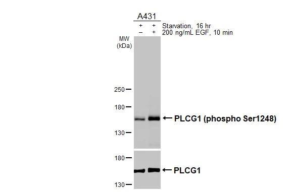 Untreated (-) and treated (+) A431 whole cell extracts (30 ug) were separated by 5% SDS-PAGE, and the membrane was blotted with PLCG1 (phospho Ser1248) antibody (NBP3-13252) diluted at 1:1000 and PLCG1 antibody  diluted at 1:1000. The HRP-conjugated anti-rabbit IgG antibody  was used to detect the primary antibody. 