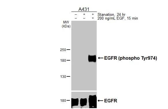 Untreated (-) and treated (+) A431 whole cell extract (30 ug) were separated by 5% SDS-PAGE, and the membranes were blotted with EGFR (phospho Tyr974) antibody (NBP3-13267) diluted at 1:2000. The HRP-conjugated anti-rabbit IgG antibody  was used to detect the primary antibody 
