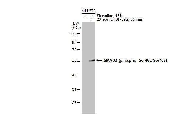 Untreated (-) and treated (+) NIH-3T3 whole cell extracts (30 ug) were separated by 10% SDS-PAGE, and the membrane was blotted with SMAD2 (phospho Ser465/Ser467) antibody (NBP3-13273) diluted at 1:1000. The HRP-conjugated anti-rabbit IgG antibody  was used to detect the primary antibody. 