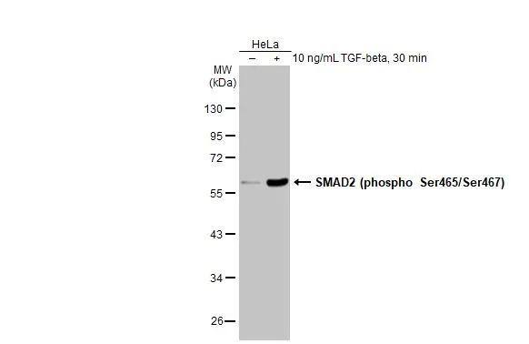 Untreated (-) and treated (+) HeLa whole cell extracts (30 ug) were separated by 10% SDS-PAGE, and the membrane was blotted with SMAD2 (phospho Ser465/Ser467) antibody (NBP3-13273) diluted at 1:1000. The HRP-conjugated anti-rabbit IgG antibody  was used to detect the primary antibody. 