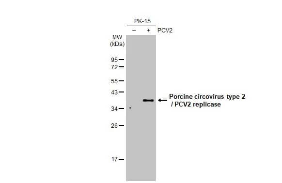 Western Blot: Porcine Circovirus 2 Replicase Antibody [NBP3-13274] - Non-infected (-) and infected (+) PK-15 whole cell extracts (15 ug) were separated by 12% SDS-PAGE, and the membrane was blotted with Porcine Circovirus 2 Replicase antibody (NBP3-13274) diluted at 1:1000. The HRP-conjugated anti-rabbit IgG antibody  was used to detect the primary antibody.