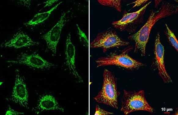 TOMM20 antibody detects TOMM20 protein at mitochondria by immunofluorescent analysis.Sample: HeLa cells were fixed in 4% paraformaldehyde at RT for 15 min.Green: TOMM20 stained by TOMM20 antibody (NBP3-13287) diluted at 1:500.Red: alpha Tubulin, a cytoskeleton marker, stained by alpha Tubulin antibody [GT114]  diluted at 1:1000.Blue: Fluoroshield with DAPI . 