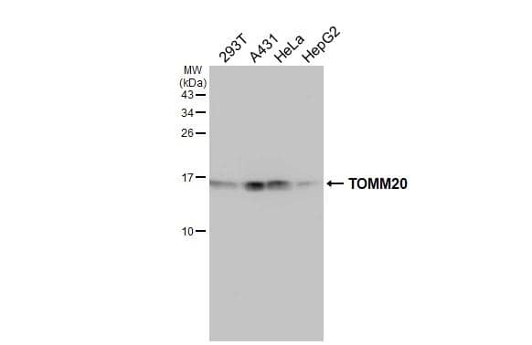 Various whole cell extracts (30 ug) were separated by 15% SDS-PAGE, and the membrane was blotted with TOMM20 antibody (NBP3-13287) diluted at 1:1000. The HRP-conjugated anti-rabbit IgG antibody  was used to detect the primary antibody. 