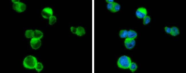 PLCB2 antibody detects PLCB2 protein at cytoplasm by immunofluorescent analysis.Sample: THP-1 cells were fixed in 4% paraformaldehyde at RT for 15 min.Green: PLCB2 stained by PLCB2 antibody (NBP3-13288) diluted at 1:500.Blue: Fluoroshield with DAPI . 